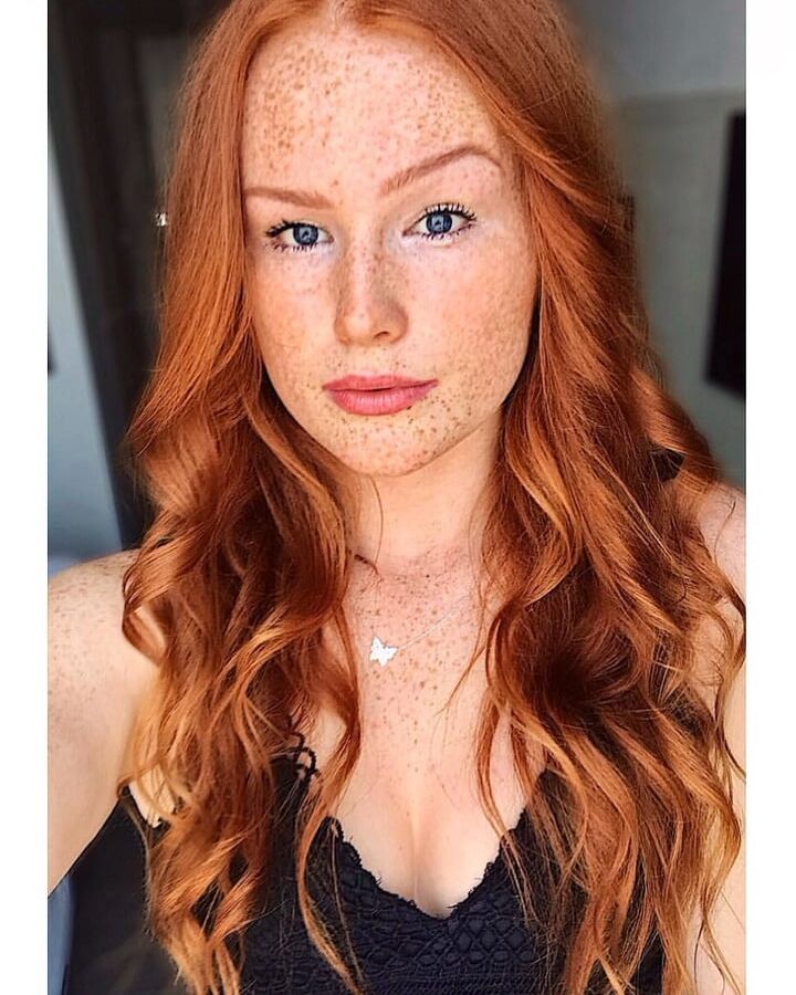 Freckled Beauty Victoria