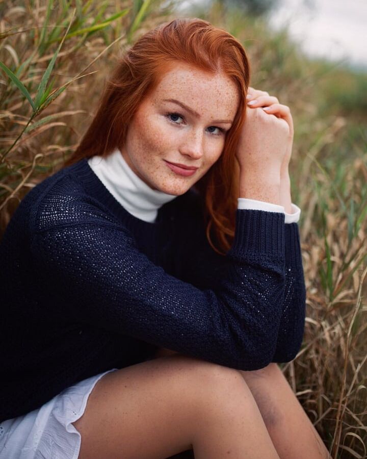 Freckled Beauty Victoria