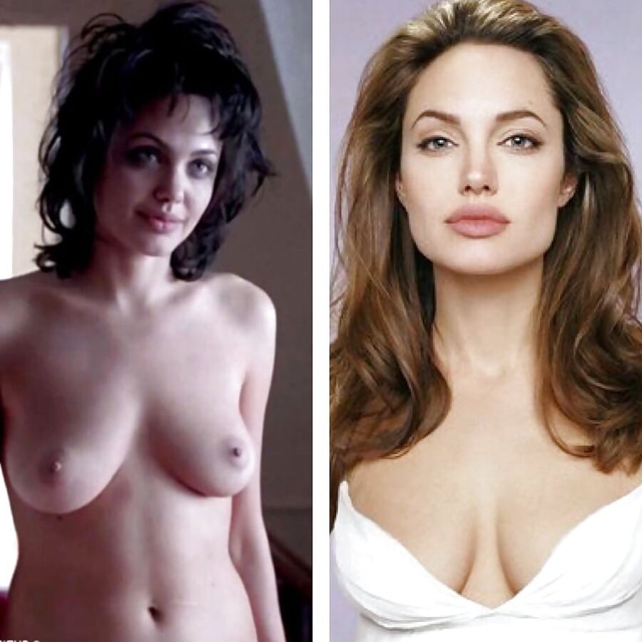 Before and After - Celebrities