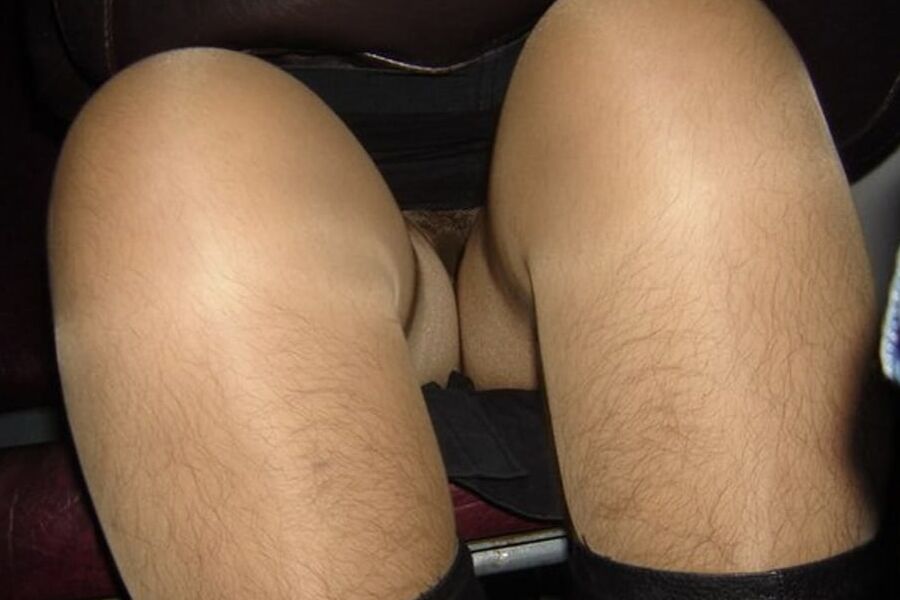 Hairy legs