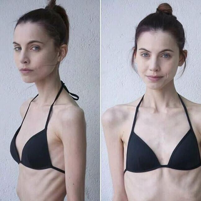 Super skinny Polish model