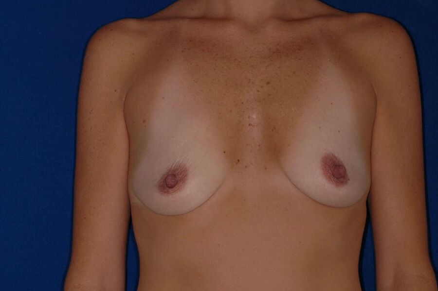 More Saggy tits