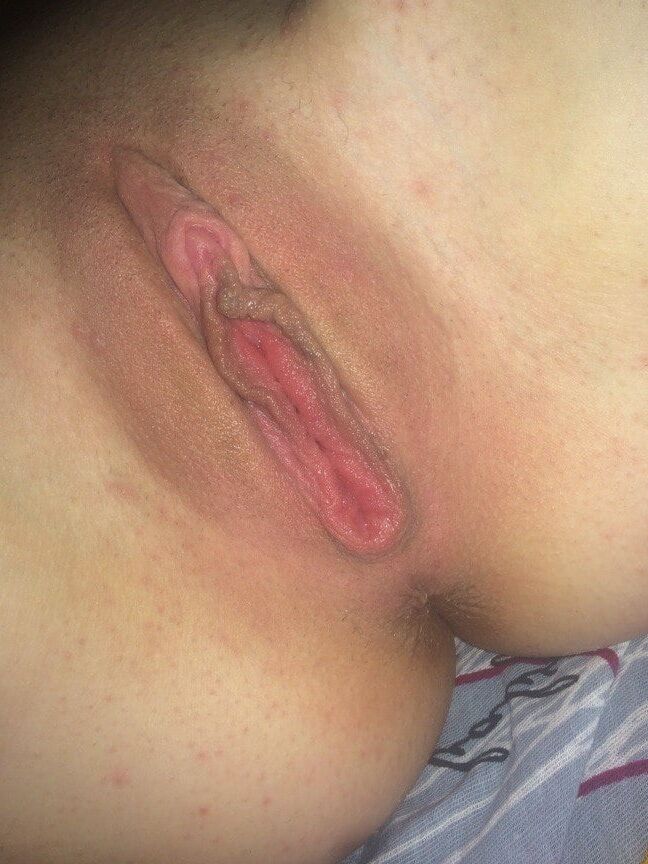 Prolaps vagina