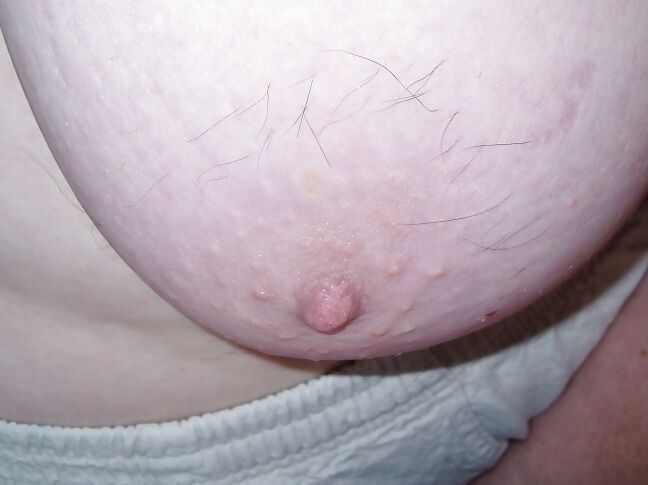 hairy nipples