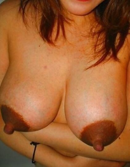 Huge nipples and areolas