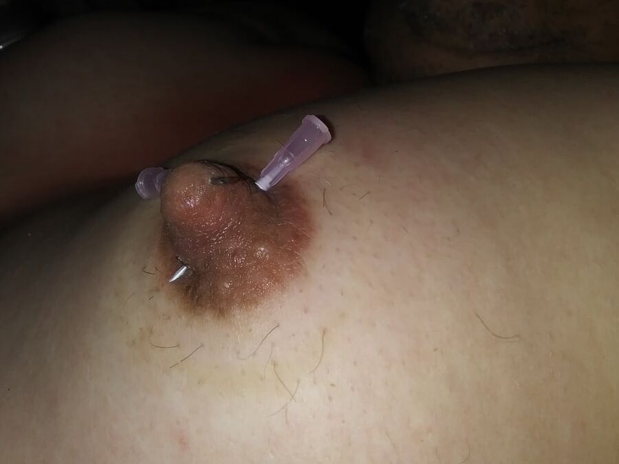 Needle nips