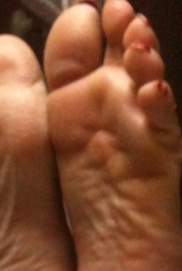 used red toenails, and soles feet after day at beach