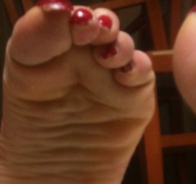 used red toenails, and soles feet after day at beach