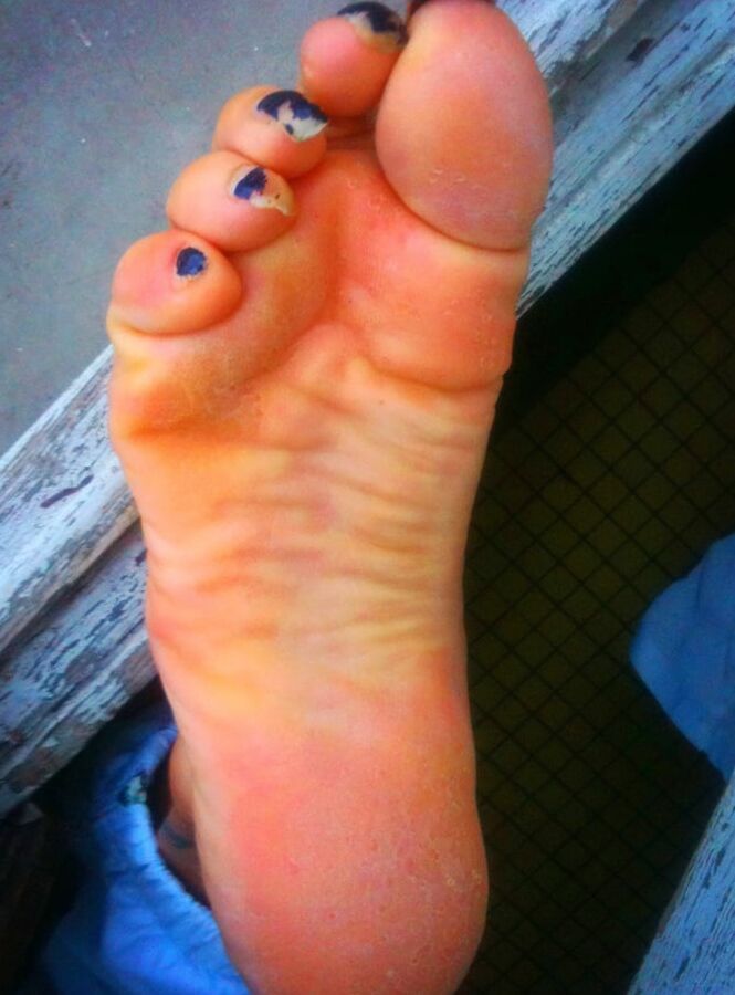 Asian ts feets, soles, toenails mix