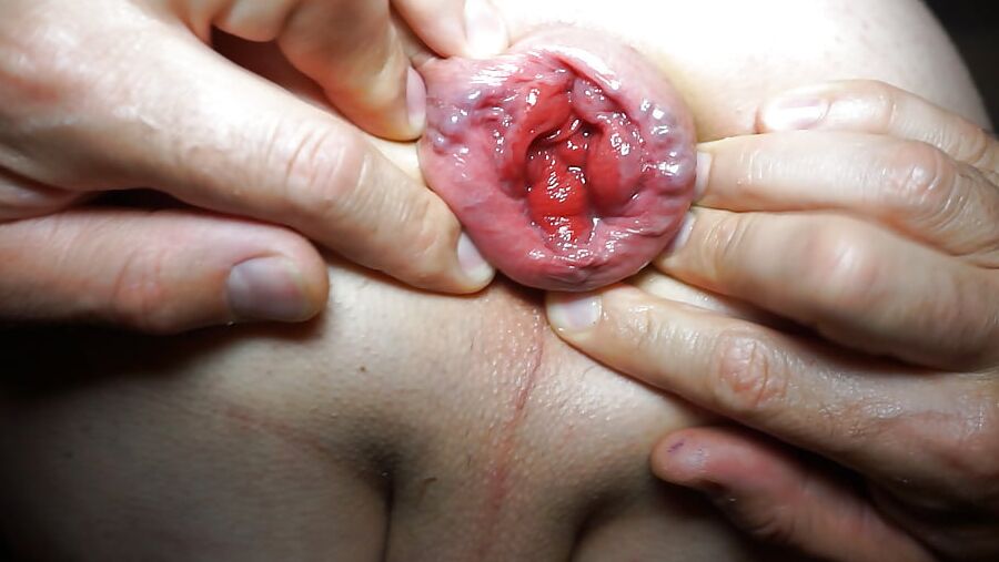Anal play with gape, prolapse and rosebud ass