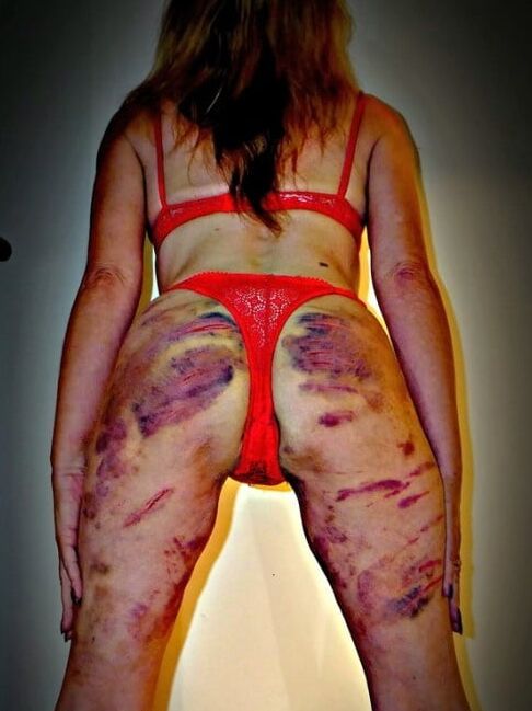 Marked girls