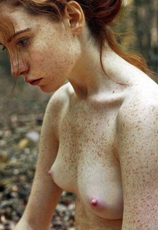 Redheads