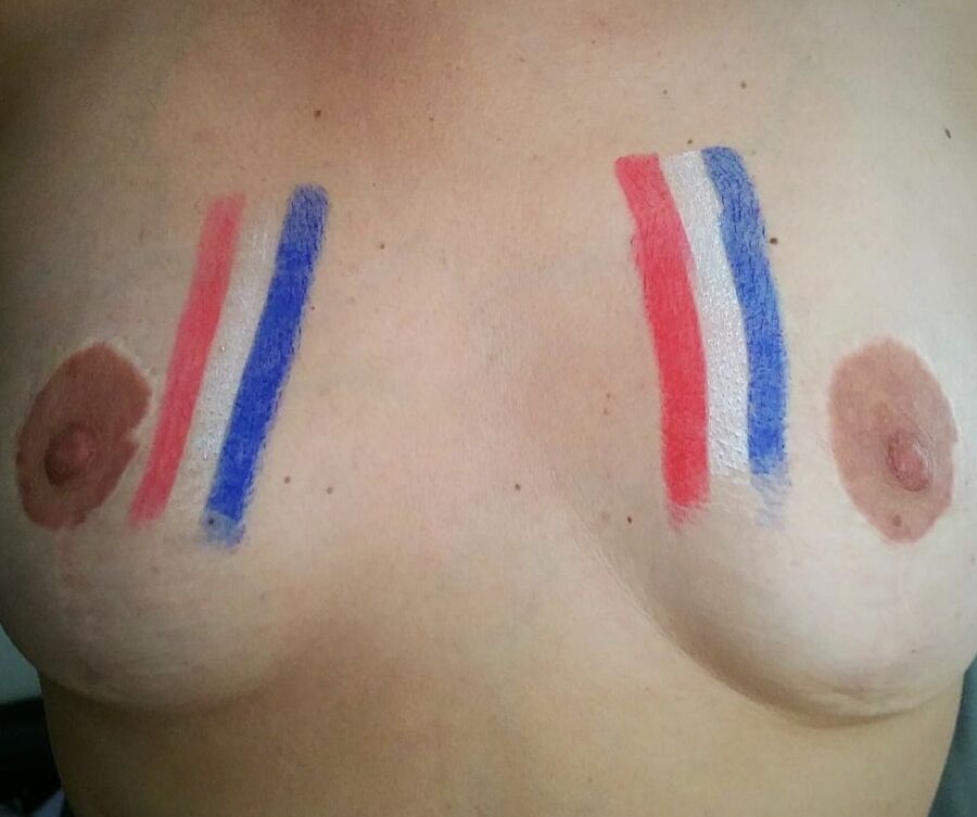 Cplcokin