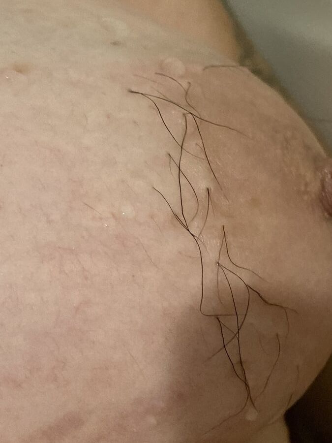Hairy nipples