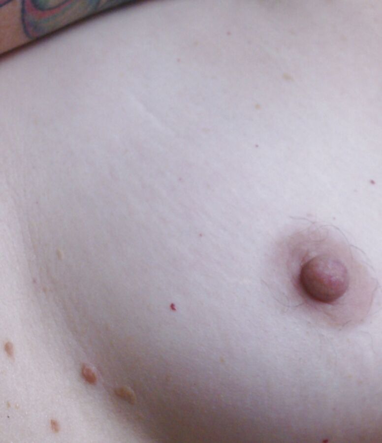 Hairy nipples