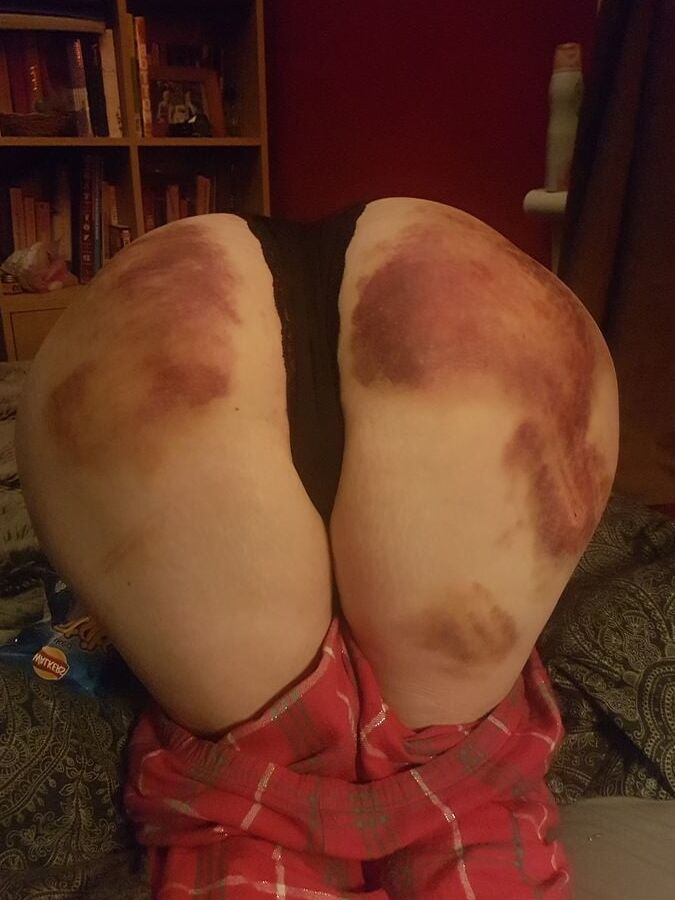 Marked girls
