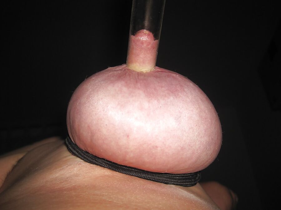 Titten abgebunden