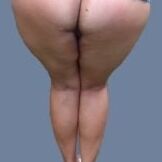 Ass