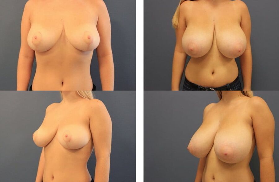 BIG BOOBS VS SMALL BOOBS