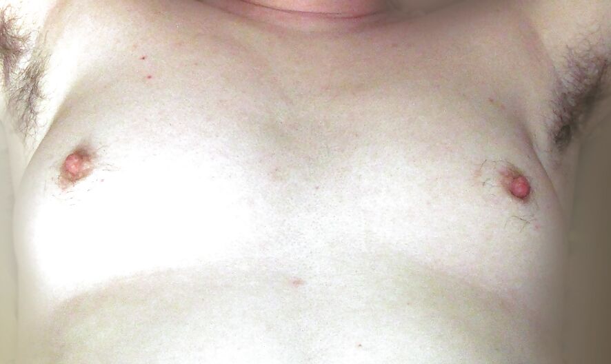 Hairy nipples