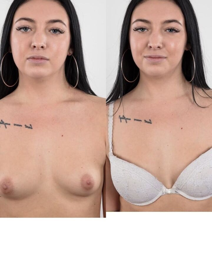 Dressed Undressed Gallery