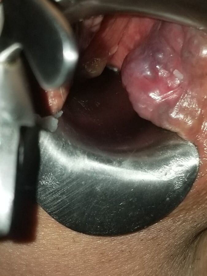 --