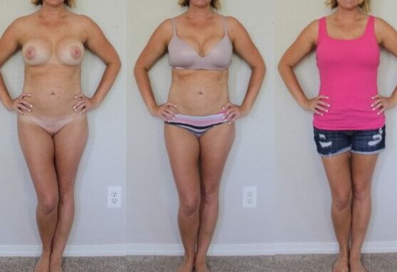 Dressed and Undressed vol