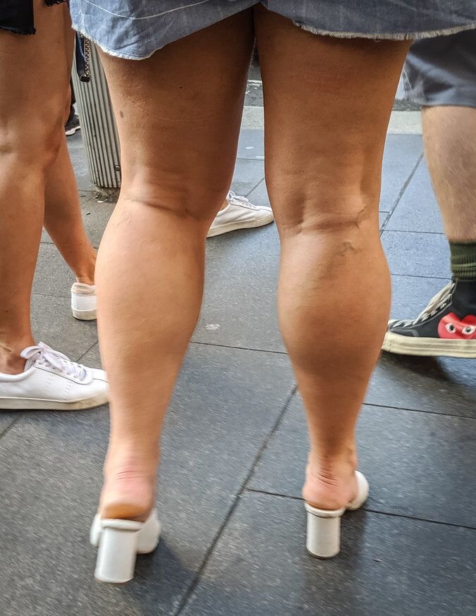 Give me a leg. Fat woman Calves.