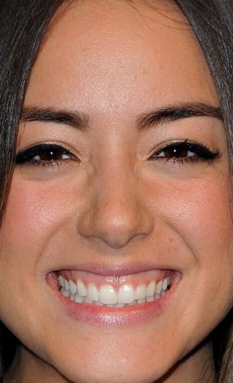 CHLOE BENNET