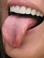 CHLOE BENNET