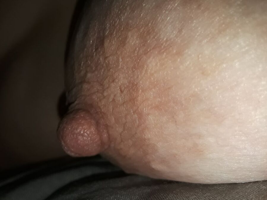 Fat Nipples