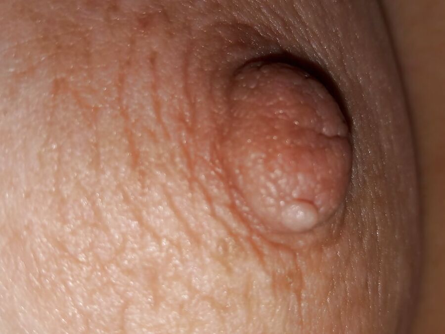 Fat Nipples