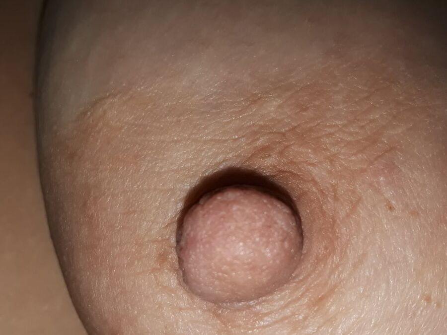 Fat Nipples