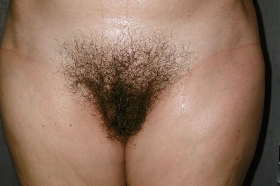 HAIRY