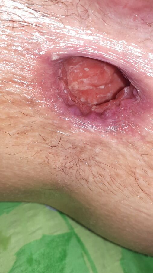 OPEN DIRTY ASSHOLE YOUNG POLISH SLUT