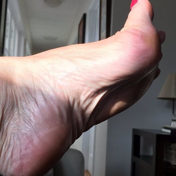 MissBunions