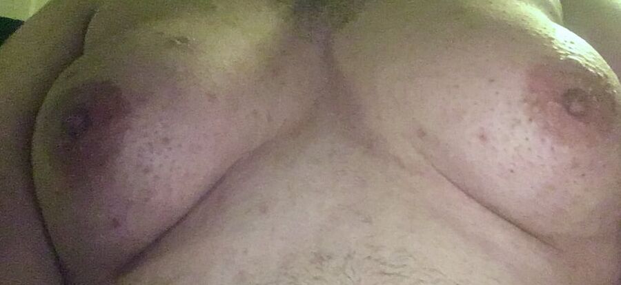 saline injection