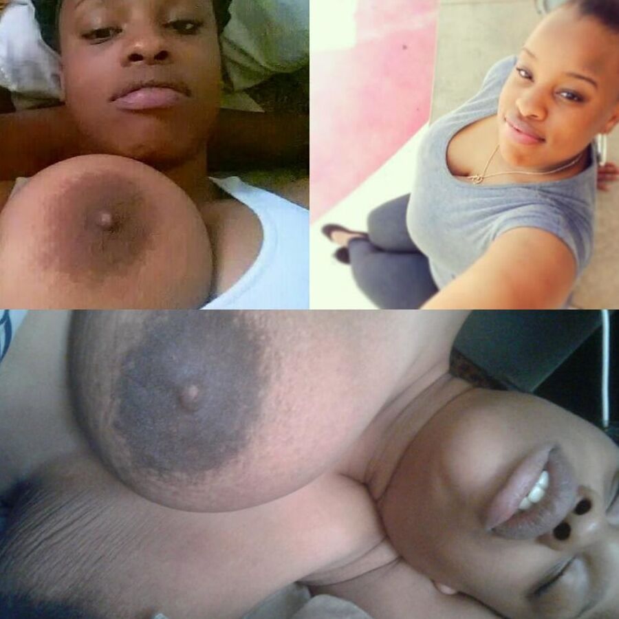 Extra big areolas