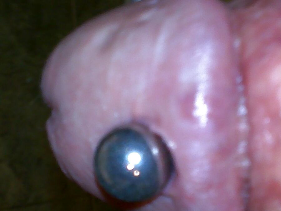 saline injection