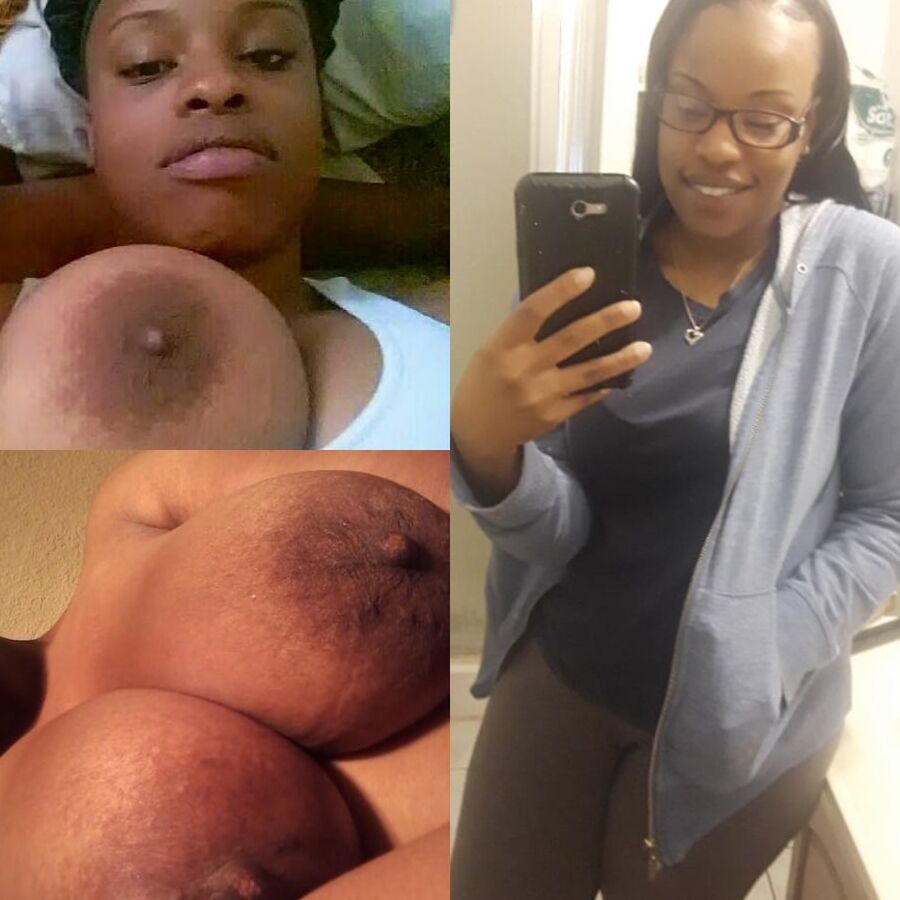 Extra big areolas