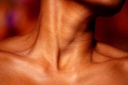 Choking and neck fetish