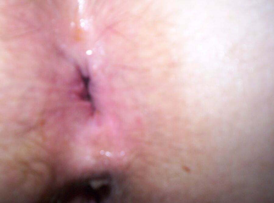 Hungarian Mature Anal Lover