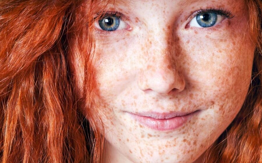 Rousse du net