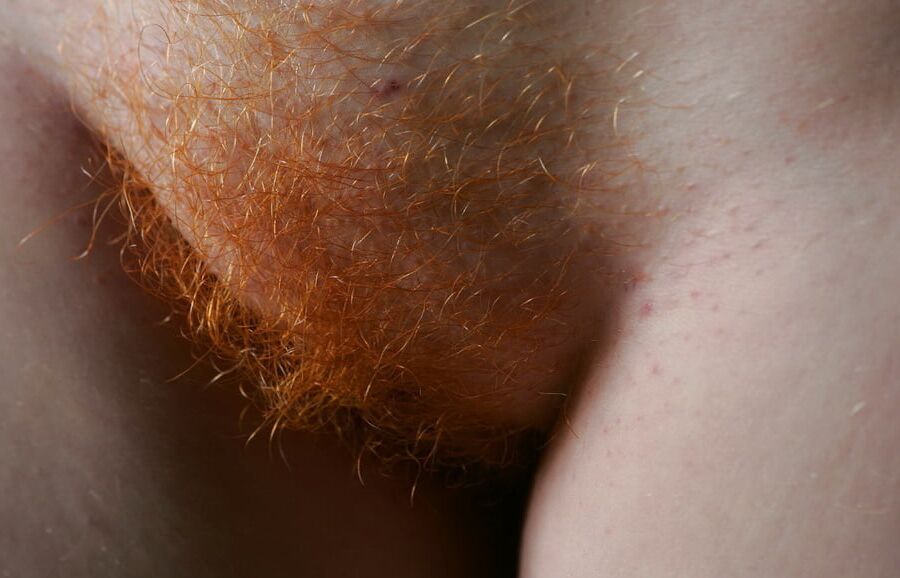 Rousse du net