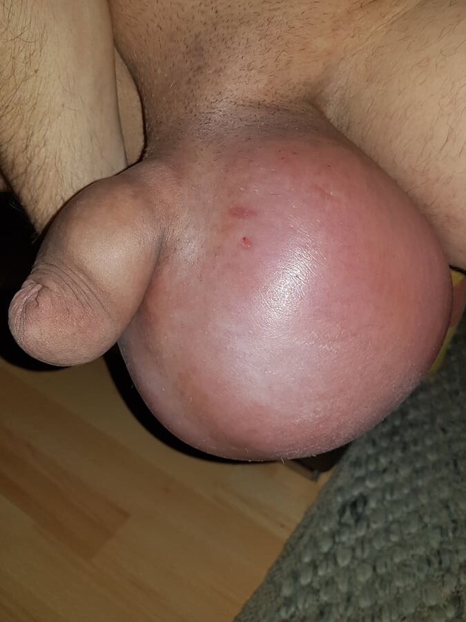 Saline Sack