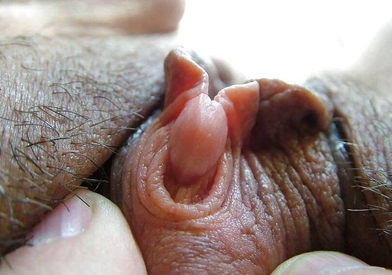 Clitoris