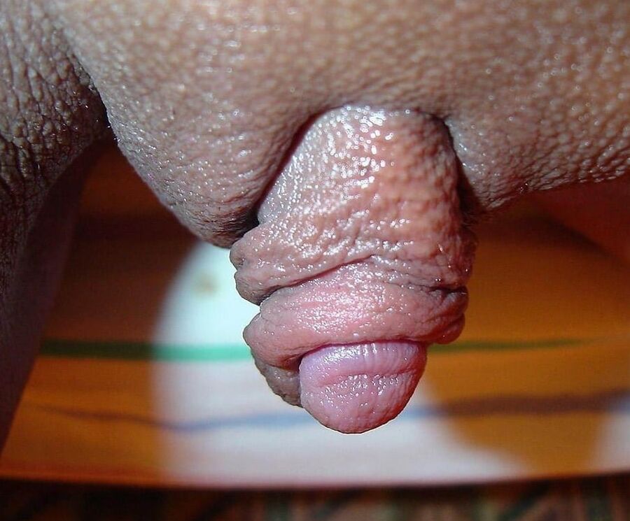 Clitoris