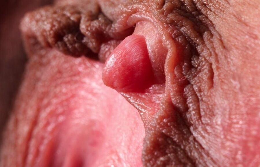 Clitoris