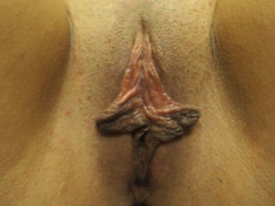 Bodies to excite