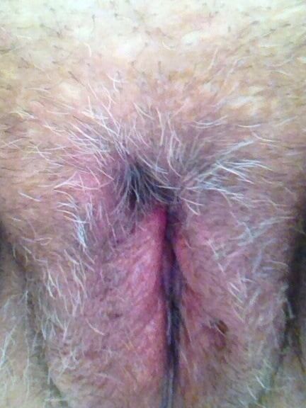 hairy